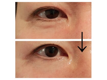 エステサロン カラーズ(COLORS)の写真