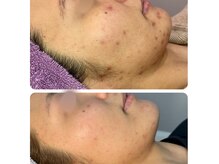 ディンプル(Dimple)の雰囲気（症例写真多数◎肌質改善サロンフェイシャル）