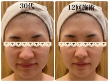 エピファニー(Epi phany Total Beauty Salon)/【小顔エステ】