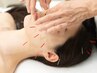 【45歳以上にお勧め】「バクチ甦生美容鍼」【通常24200円】