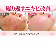 サロンドエステケイワイ(de KY)