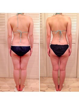 ビューティスペース バーディー(beauty space Birdy)/☆Before→After（後）☆