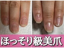 スターネイル(Starnail)/ほっそり理想の爪の形・自爪育成
