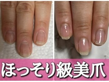 ほっそり理想の爪の形・自爪育成