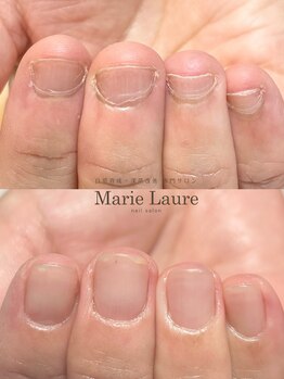 マリーロール 淀屋橋本店(Marie Laure)/自爪育成/深爪矯正/ネイルケア