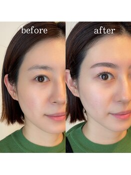 ビビッド(vivid)/ハリウッドブロウリフト