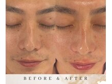 ゼロ アンド リセット(0ZERO&RESET)/【メンズ脱毛】0ZERO&RESET