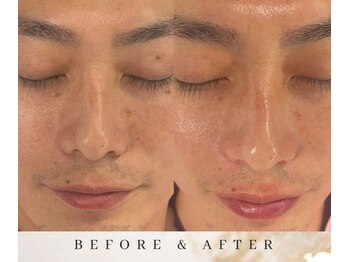 ゼロ アンド リセット(0ZERO&RESET)/【メンズ脱毛】0ZERO&RESET