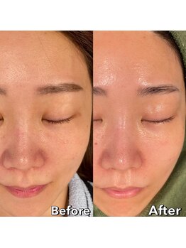 ベル(belle)/韓国式 艶玉肌★