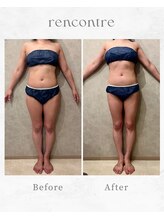 ランコント(rencontre)/肩こり/リンパ/ヘッドスパ/痩身