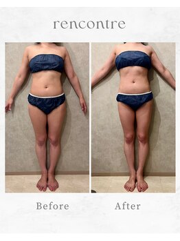 ランコント(rencontre)/肩こり/リンパ/ヘッドスパ/痩身