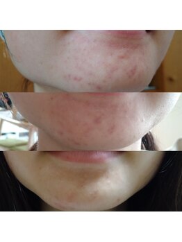 レディアント 石神井公園(radiant)/石神井公園/フェイシャル