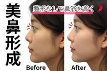美鼻形成×毛穴洗浄サロン・アトリエノーズ 表参道店