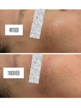 フォーエリミスプラス(for elims+)/【お客様の変化】