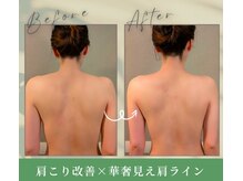 トータルボディサロン グリーン 日本橋駅前店(Green)/肩こり解消！リンパマッサージ