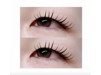 ブライズ(BRISE)/バインドロック