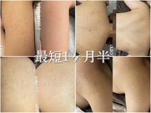 プラウディア(PROUDIA)の雰囲気（ダイエット/痩身エステ/ハーブピーリング/ハーブリプロ/脱毛）