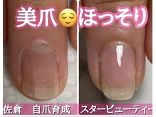 スターネイル(Starnail)/自爪育成でお爪ほっそり美人爪