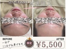 マヴィ 香里園店(MavY.)/リフトアップ小顔効果◎