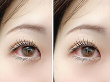 エンヴィバイコスメーア(Envy by Cosmea)/うる艶ラッシュリフト☆