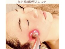 ヒト幹細胞培養液を導入し、コラーゲンの活性化へと導きます。