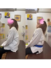 ヒデ整体院(Hide整体院)/猫背矯正骨盤矯正B/A肩こり腰痛