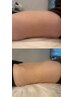 ★腸活・便秘、おなかの不調に【腸もみ/ガス抜き70分】くびれにも◎