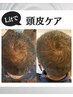 《美髪ケア》【頭皮洗浄+ヒト臍帯・羊膜幹細胞上清液】抜け毛改善コース♪