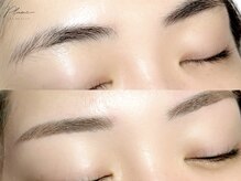 プリュームアイビューティー 銀座一丁目店/【Before&After】