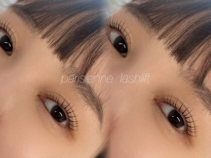 ミニョン(Mignon)の写真