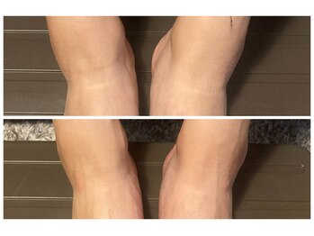 ハナワクシングプラス 高知(HanaWaxing+)/【台湾式足つぼ】