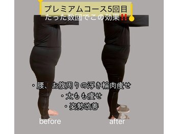 ヨサパーク ラウレアボディ 昭島店(YOSA PARK Laule'a Body)/お客様のbefore/after