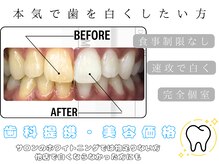 ルナベル(Luna Bell)