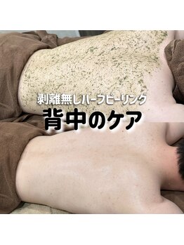 アマリリス(Amaryllis)/背中ハーブピーリング