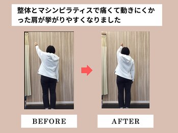 富雄みなみ整骨院/施術後ビフォーアフター