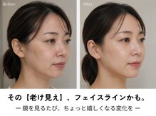オニュ(ONYU)