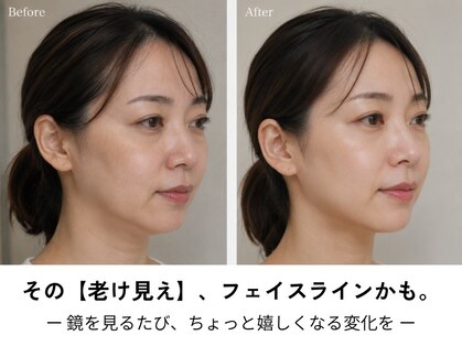 オニュ(ONYU)の写真