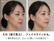オニュ(ONYU)の写真