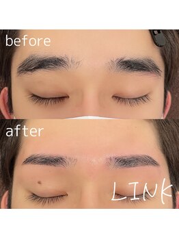 リンク(LINK)/下がり眉でお悩みの方
