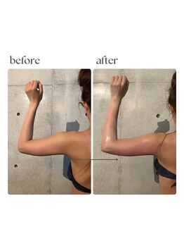 ボーレーヴ 表参道店(beaureve)/施術効果写真(before after)