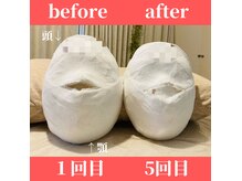 ロータス ビューティー(LOTUS Beauty)の雰囲気（回数を重ねる程小顔へ☆石膏パックでお顔の変化を確認できます。）