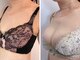 美人バスト 仙台店の写真/【成功例多数！】夏に水着を着たい方必見☆医療機関提携バストアップ専門店！体験9900円