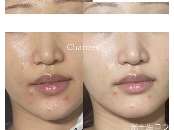 シャルトルズ 西宮北口店/