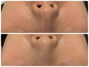 エフェクト 塚口店(effect)/Before After