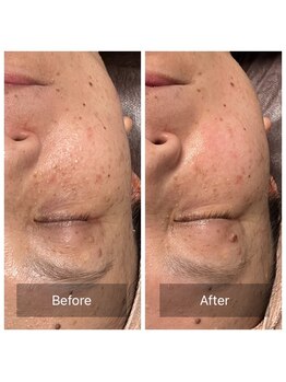 きこりのいずみ/美容医療に頼らなくても・・・