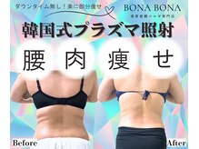 ボナボナ 仙台立町(BONA BONA)/背中ハミ肉・腰肉を撃退したい！
