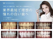 ホワイトニングショップ 栃木佐野店