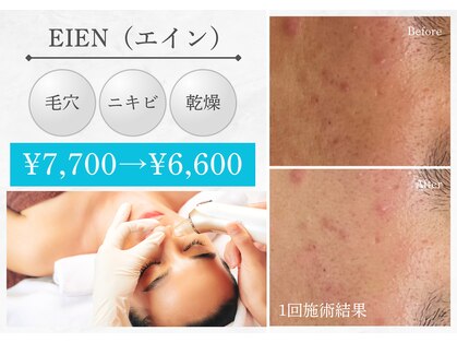 アデージョ アデオス(Ade-jyo.Adeosu)の写真