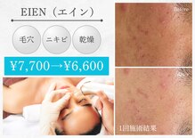 アデージョ アデオス(Ade-jyo.Adeosu)