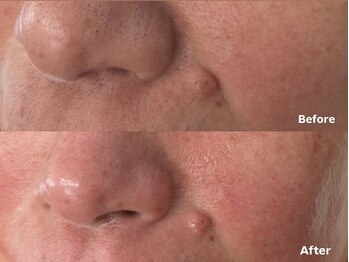 アイロンボーイ(IRONBOY)/艶肌お顔全体WAX